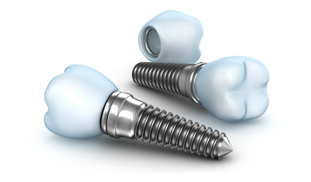 Maintain your Dental Implants Properly